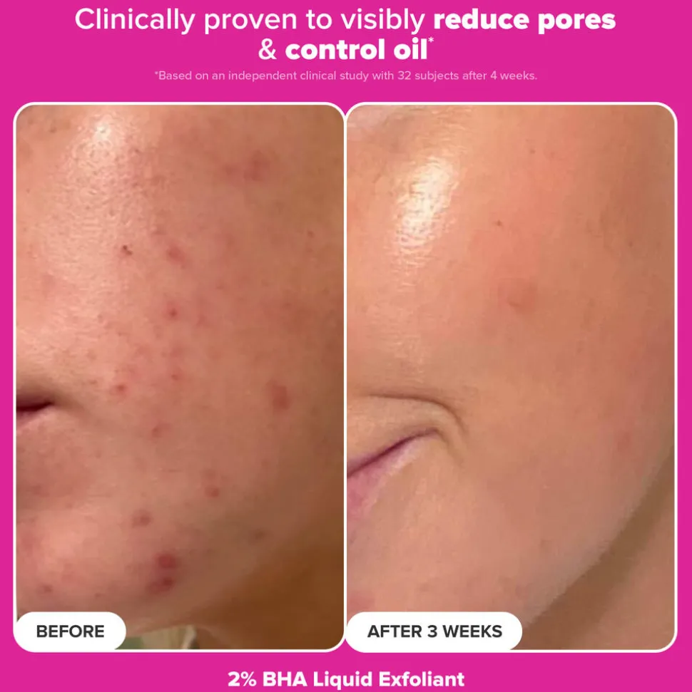 The Plump & Glow Kit