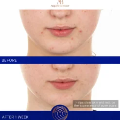 The Retinol Serum 30ML