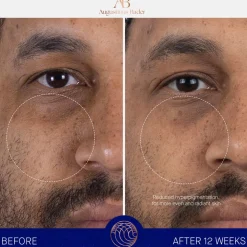 The Serum 50ML