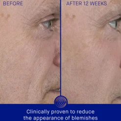 The Serum Refill