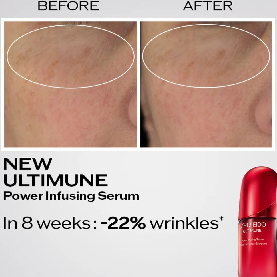 Ultimune Power Infusing Serum 50ML
