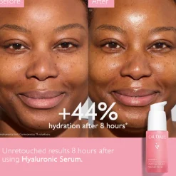 VinoHydra Hyaluronic Serum 30ML