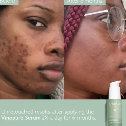 Vinopure Blemish Serum 30ML