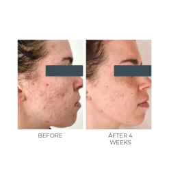 Violet Water D-Spot Clearing Blemish Treatment 25ML