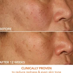 Vitamin C + Lactic 15% Vitamin C Firm & Bright Serum 30ML