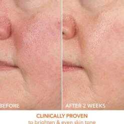 Vitamin C + Lactic 15% Vitamin C Firm & Bright Serum 30ML