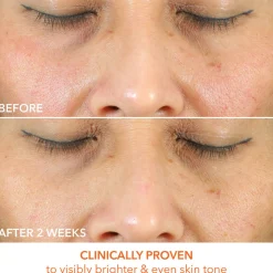 Vitamin C+Lactic Oil-Free Radiant Moisturizer 50ML